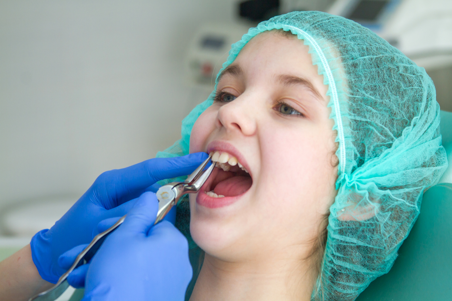 Dental Extraction 